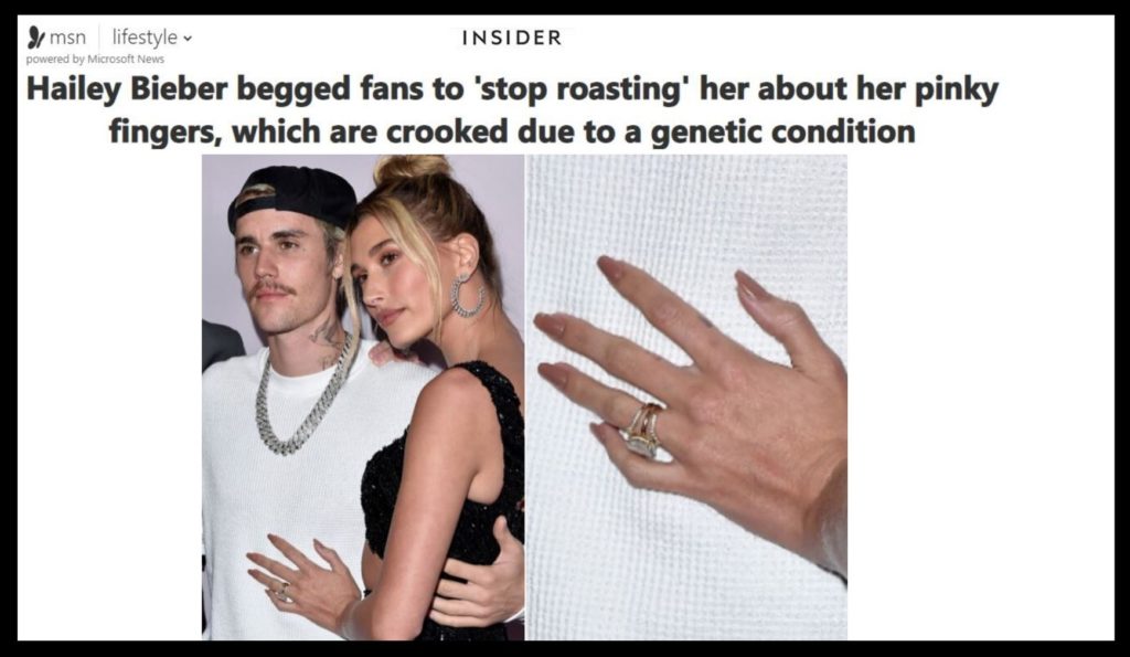 Hailey Bieber Begged Fans To ‘stop Roasting’ Her About Her Pinky Fingers Which Are Crooked Due